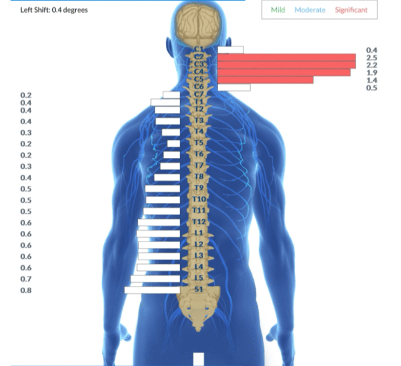How Adjustments Help You Sleep: The Complete Guide to Better Rest 2 | PX Docs