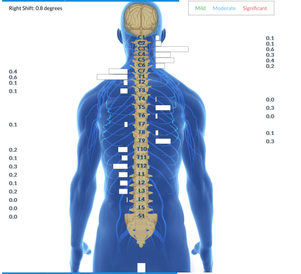 How Adjustments Help You Sleep: The Complete Guide to Better Rest 3 | PX Docs