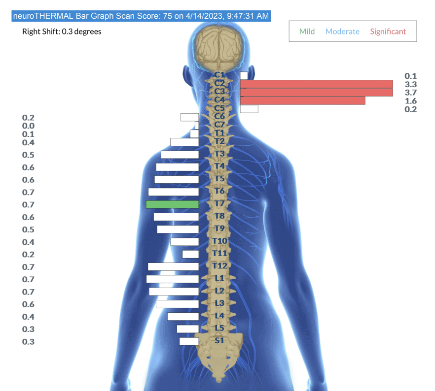 Why Primary Subluxation Patterns Reappear During Care en Espanol 1 | PX Docs