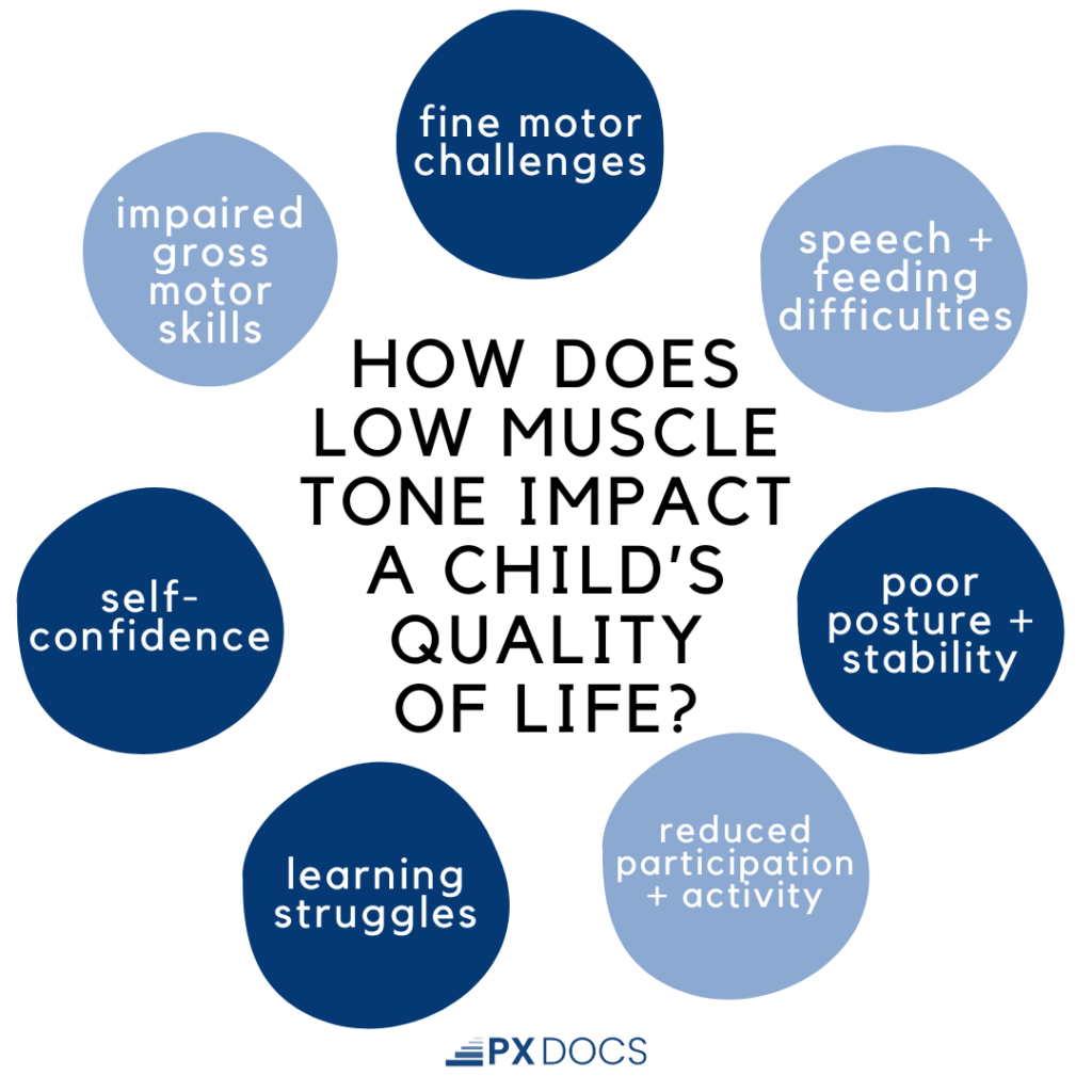 Low Muscle Tone in Children with Autism: A Guide for Parents 2 | PX Docs