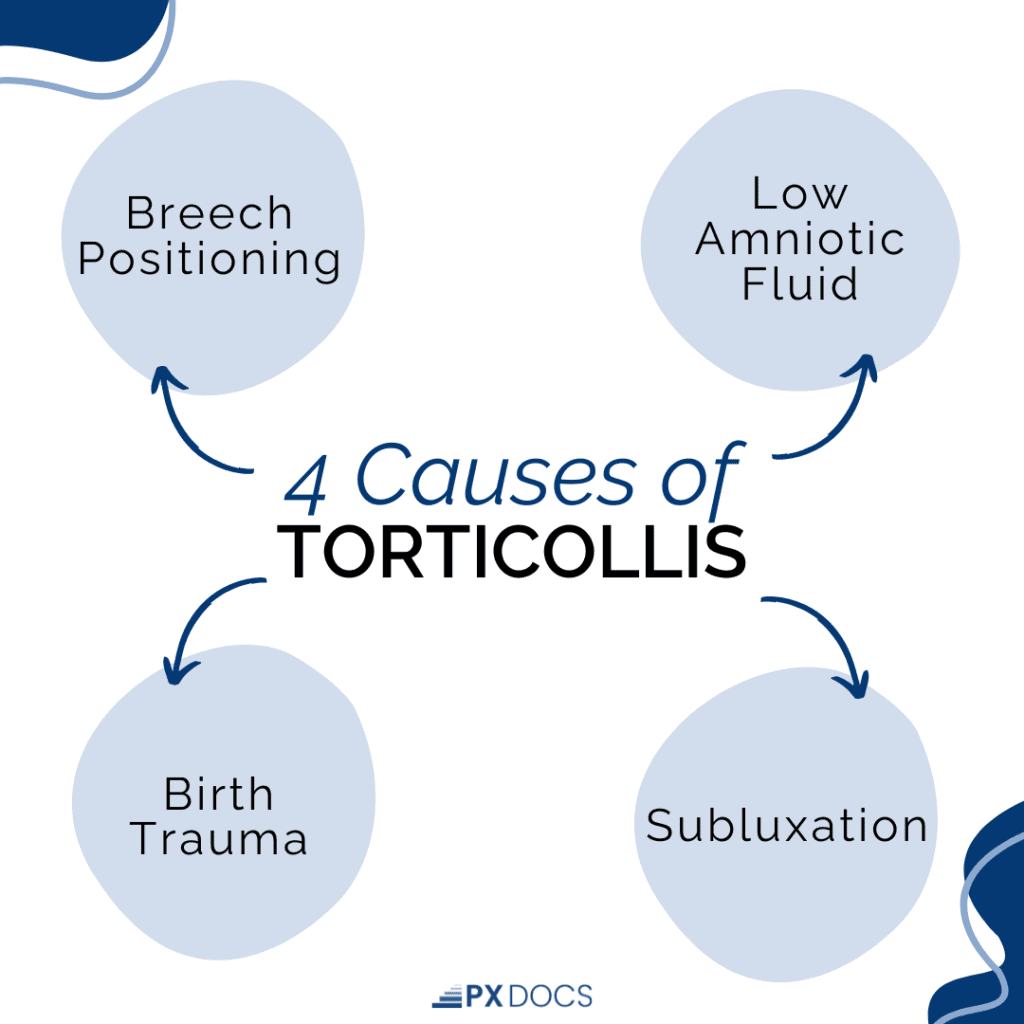 What Is Infant Torticollis? 1 | PX Docs